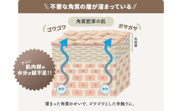 不要な角質の層が溜まっている 溜まった角質のせいで、ゴワゴワとした手触りに。