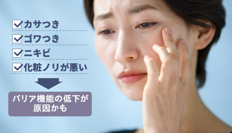 カサつき ゴワつき ニキビ 化粧ノリが悪い バリア機能の低下が原因かも