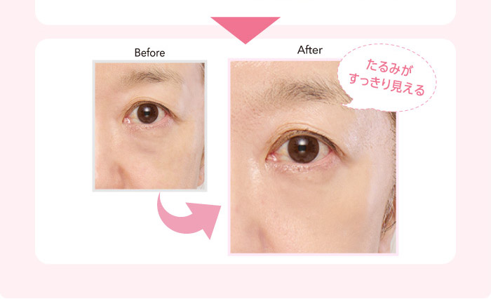 Before After