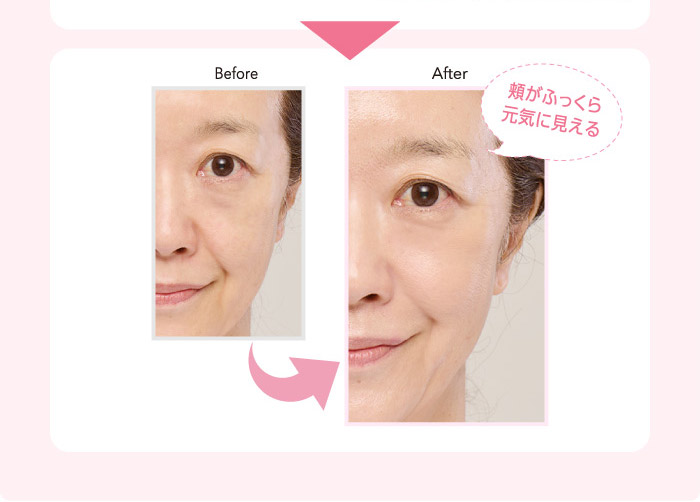 Before After