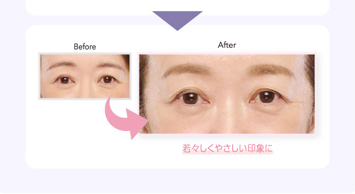 Before After