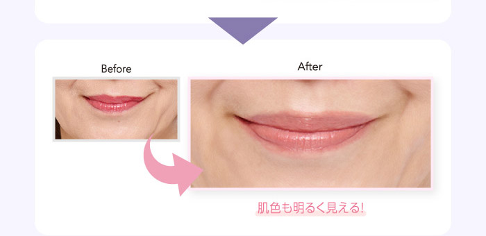 Before After
