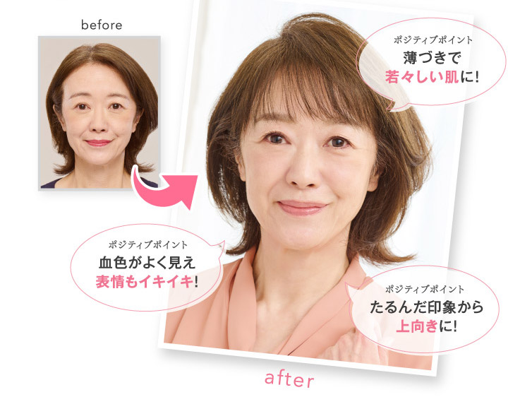 Before After